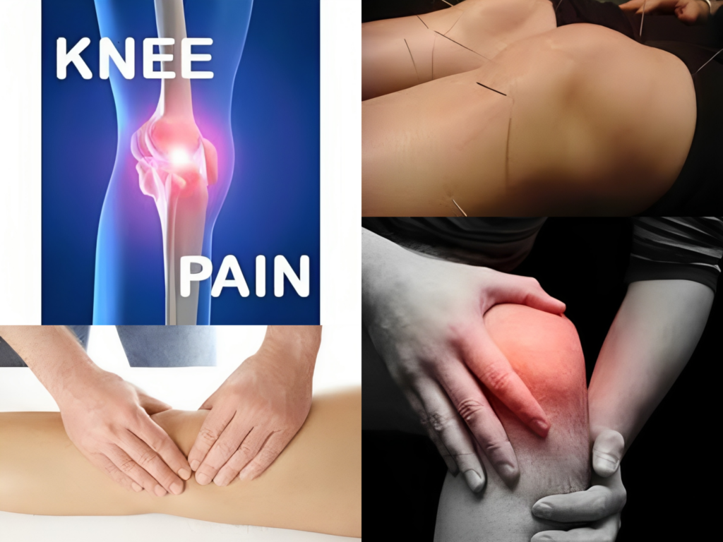 Knee Pain and Acupuncture