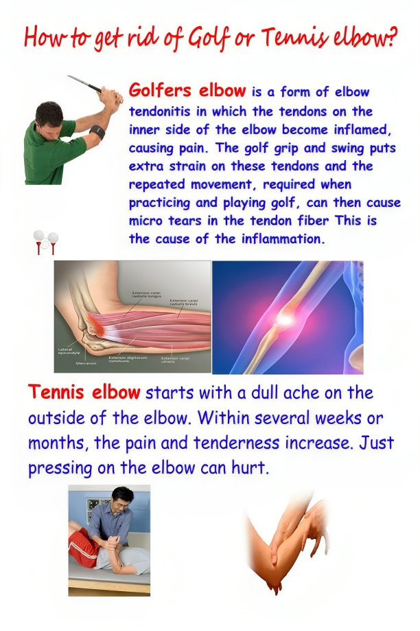 Golf Elbow and Acupuncture